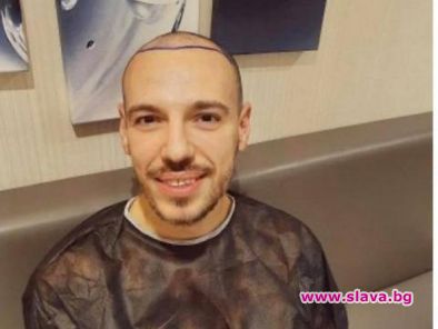 Даниел Петканов си присади коса на аванта преди три месеца