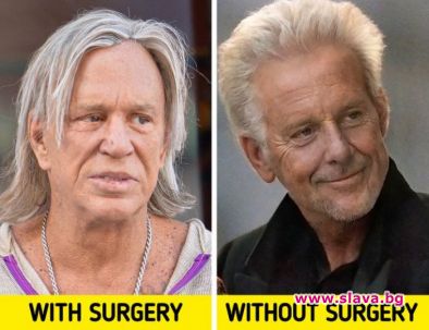 Ботоксът и козметичната хирургия са популярни сред холивудските знаменитости Видът