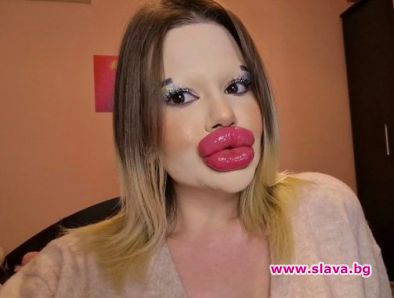 Българката Андреа Иванова има най големите устни в света а до