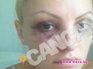 Пребиха полулярната румънска певица Александра Стан