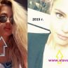 Кристин Илиева започна и с лицевите подобрения