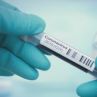 Тестваха успешно ваксина срещу COVID-19 върху маймуни