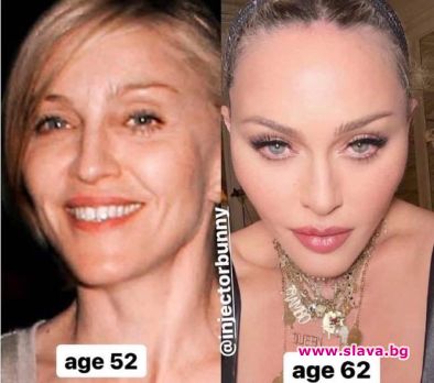 Мадона или маска: 10 г. разлика