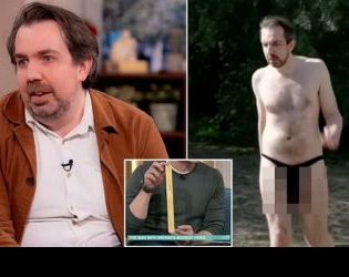 Мъжът с най-големия пенис във Великобритания разкри недостатъците от това