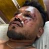 Чудо на седалка 11А: какво знаем за единствения оцелял в катастрофата на Air India Вишваш Кумар 