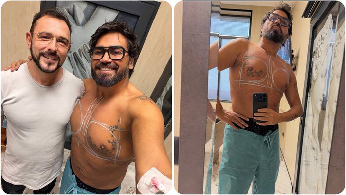 Азис постави импланти в гърдите си