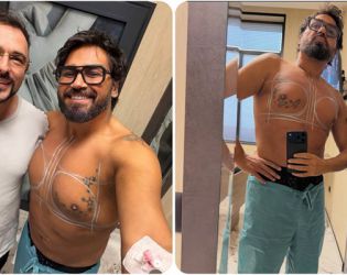 Азис постави импланти в гърдите си