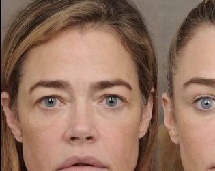 Дениз Ричардс показа резултатите от лифтинг с „преди и след“ снимки